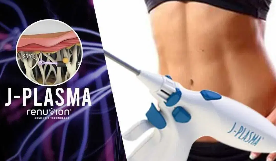 Renuvion J Plasma